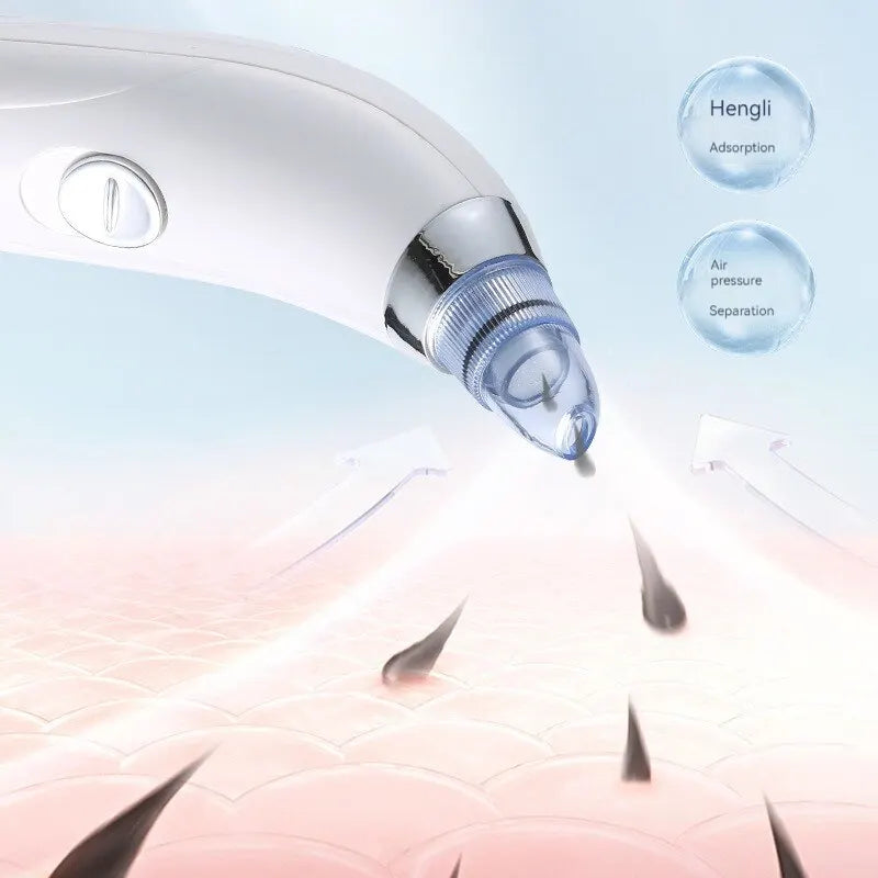 Suction Blackheads God Electric Blackheads Instrument Go Blackheads Face Pore Cleansing Beauty Instrument